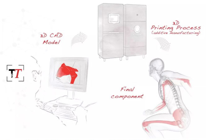 骨科3D打?。汗怩r外衣掩蓋下的骨感賽道