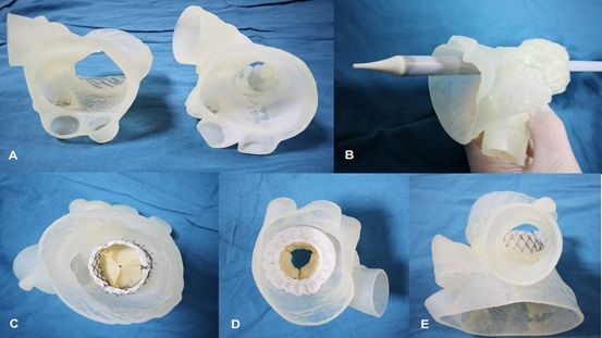 逐漸納入醫(yī)保范圍的3D打印模型，將會對醫(yī)工結(jié)合帶來哪些不同？